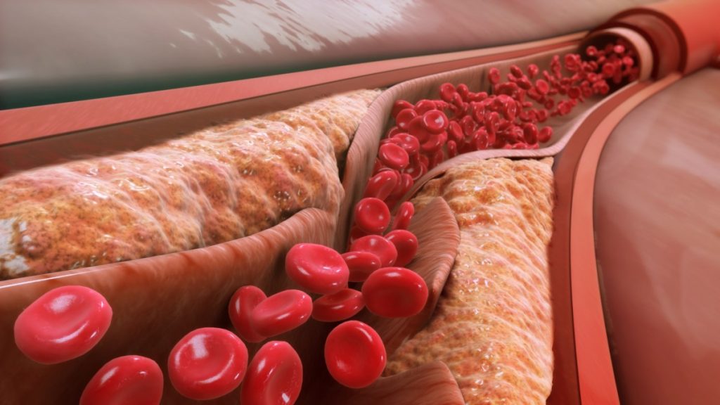 Lower Triglycerides