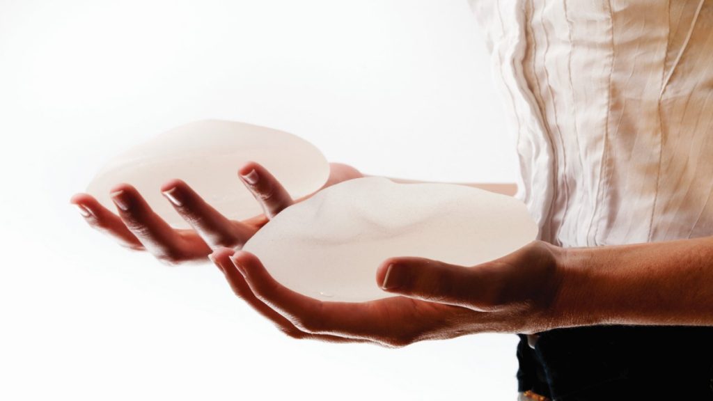 Breast Augmentation