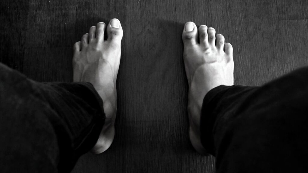 Burning Feet Syndrome