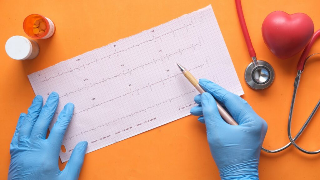 Sudden Cardiac Death