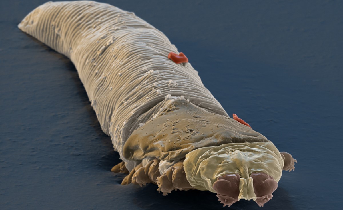 This Tiny Mite Can Live Its Whole Life on Our Faces - Gazettely