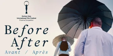 Before/After Review