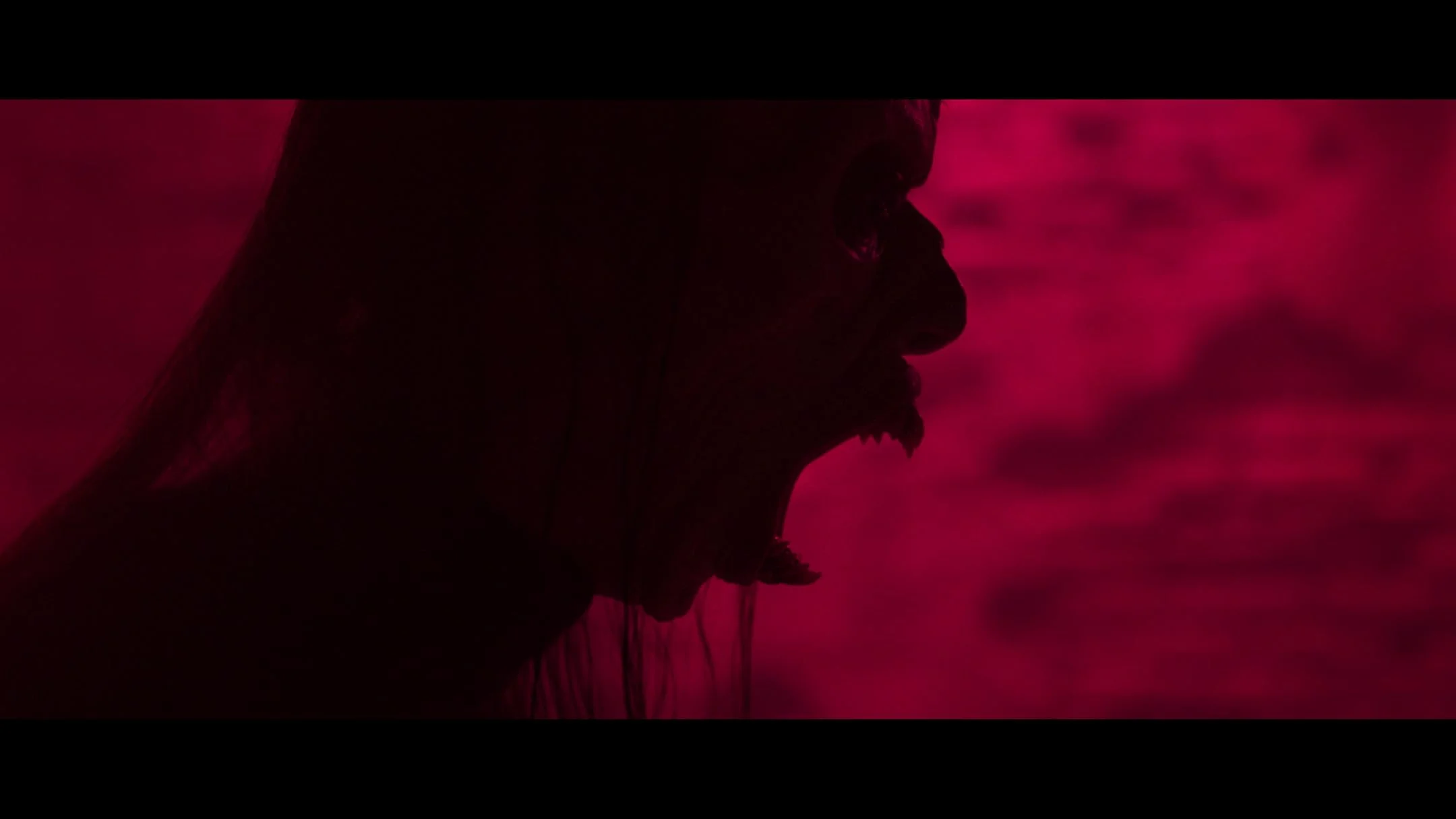 Parasomnia Review: Sleep Turns Against Riley 42 Parasomnia Review