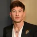 Barry Keoghan Reveals Skin-Tightening Treatment Months After Speaking Out on Online Abuse 2 Barry Keoghan